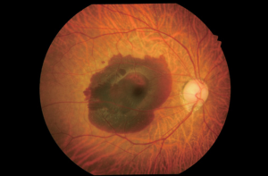 Kowa-Ophthalmic-Diagnostics-VX-20-Screenshot01