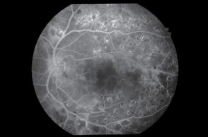 Kowa-Ophthalmic-Diagnostics-VX-20-Screenshot02